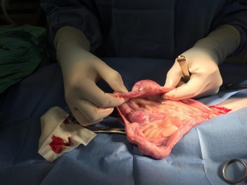 Surgical artificial insemination
